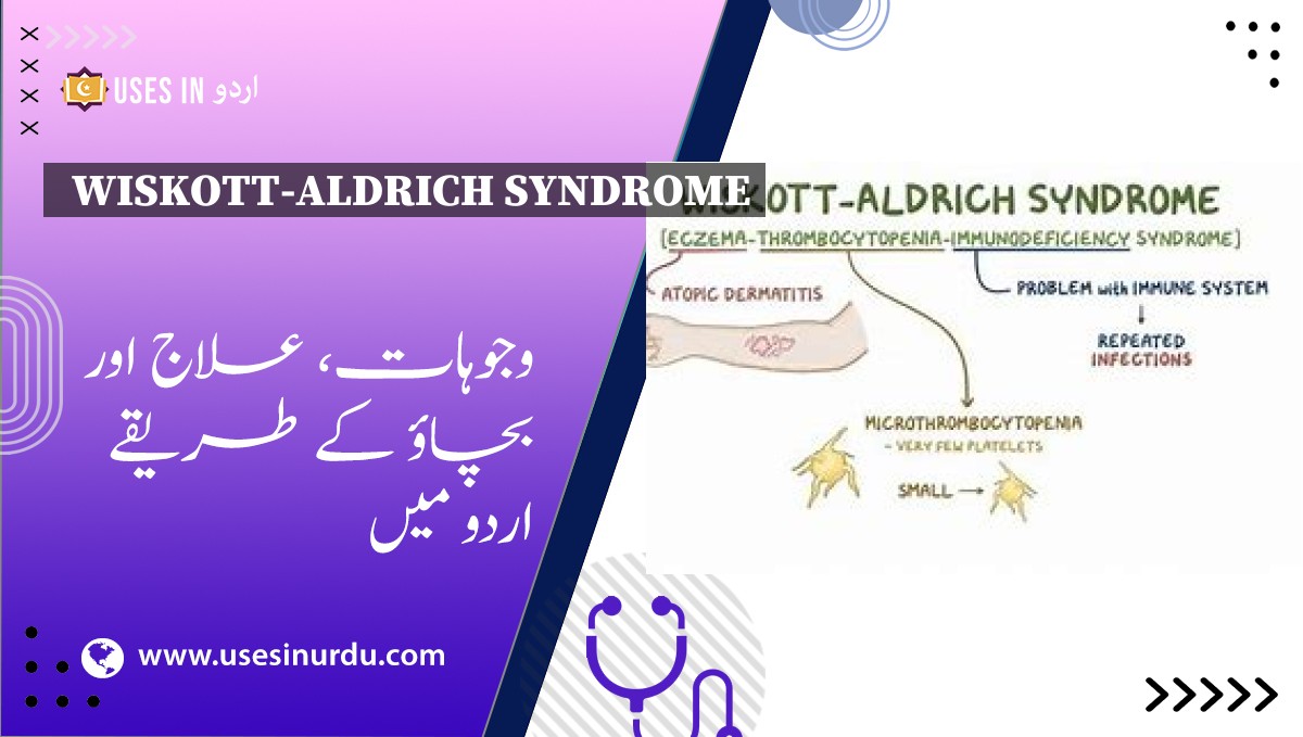 Wiskott-Aldrich Syndrome