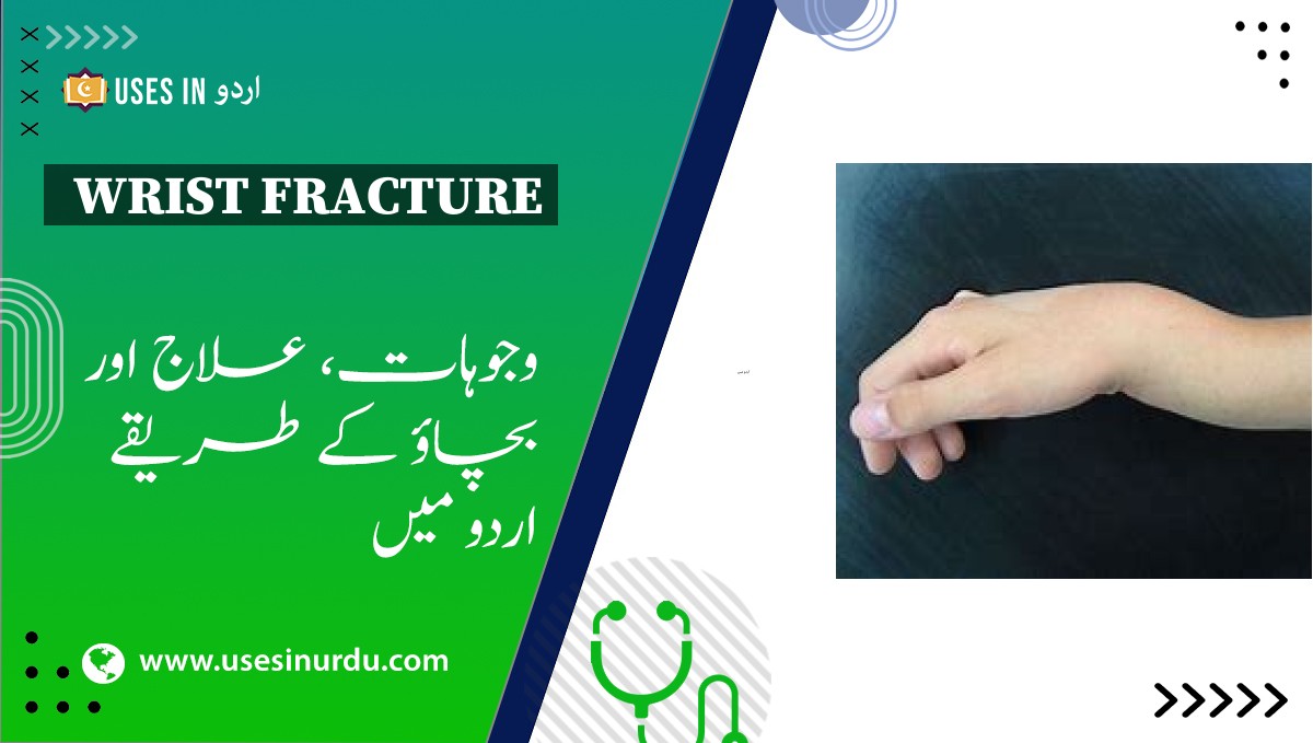 Wrist Fracture