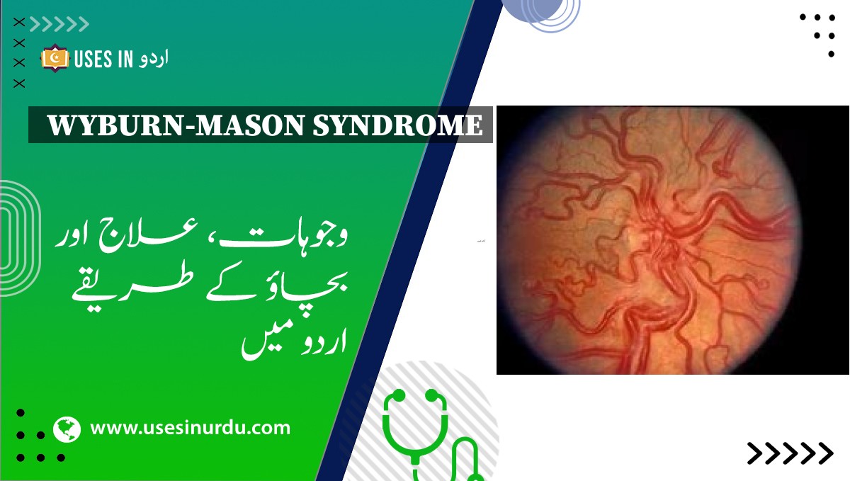 Wyburn-Mason Syndrome