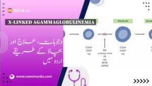 X-Linked Agammaglobulinemia