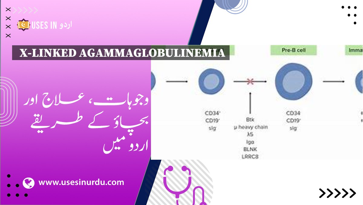 X-Linked Agammaglobulinemia