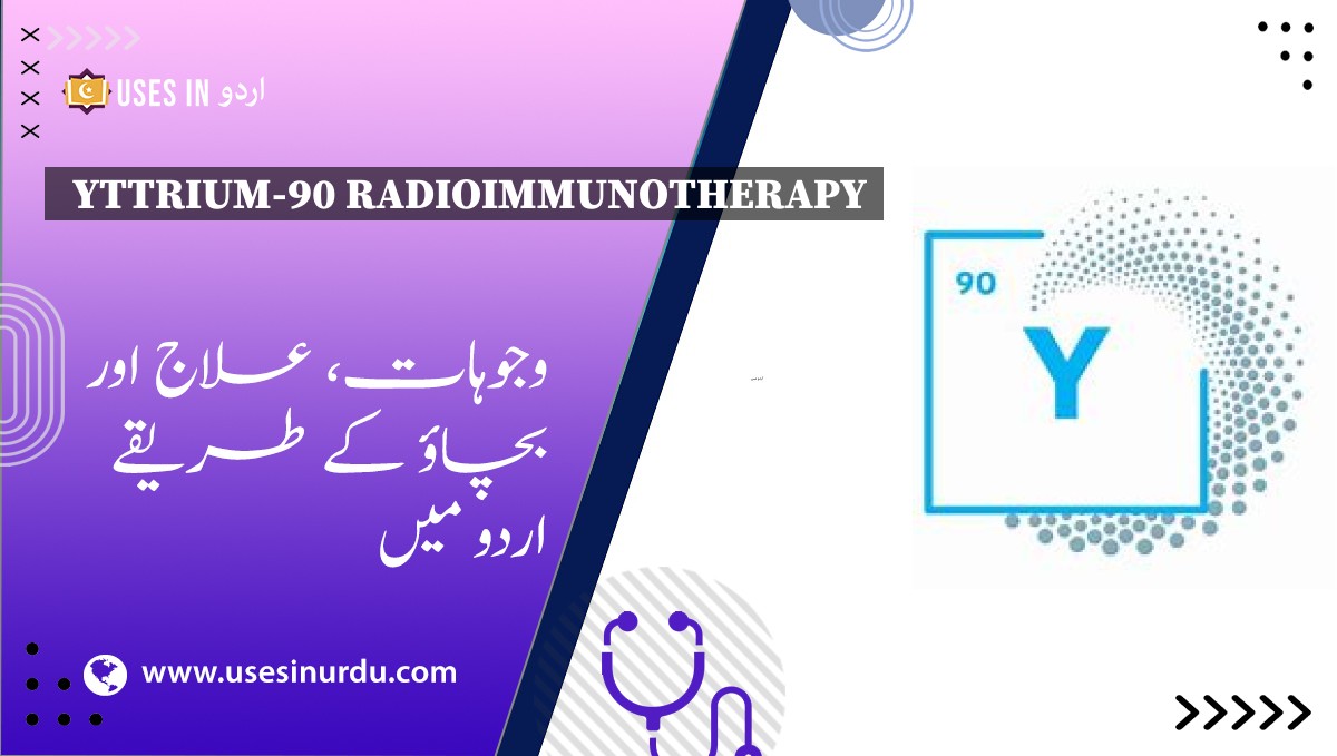 Yttrium-90 Radioimmunotherapy