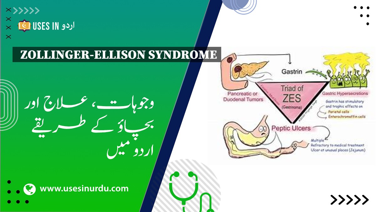 Zollinger-Ellison Syndrome