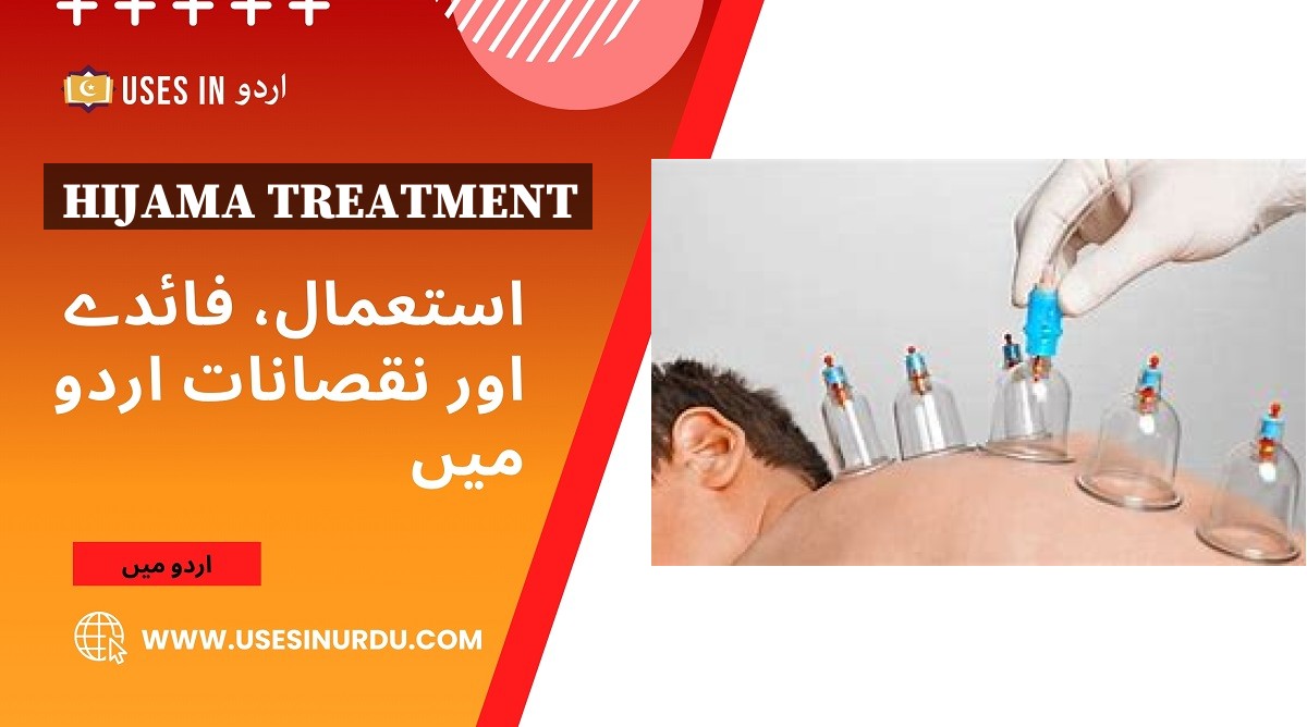 Hijama Treatment