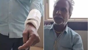 ڈاکٹرز نے زخمی بیٹے کی تیمار داری کیلئےہسپتال گئے باپ کا آپریشن کردیا