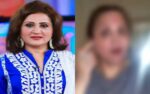 اسما عباس کا جلدی علاج سے چہرہ متاثر، تصویر بھی شیئر کردی