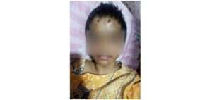 چائلڈ پروٹیکشن بیورو نے تشدد کا شکار 12سالہ گھریلو ملازمہ کو بازیاب کروا کر تحویل میں لے لیا