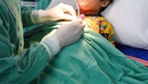 فیصل آباد میں 3 سالہ بچے کا کامیاب آپریشن، گلے میں پھنسا تالا نکال لیا گیا